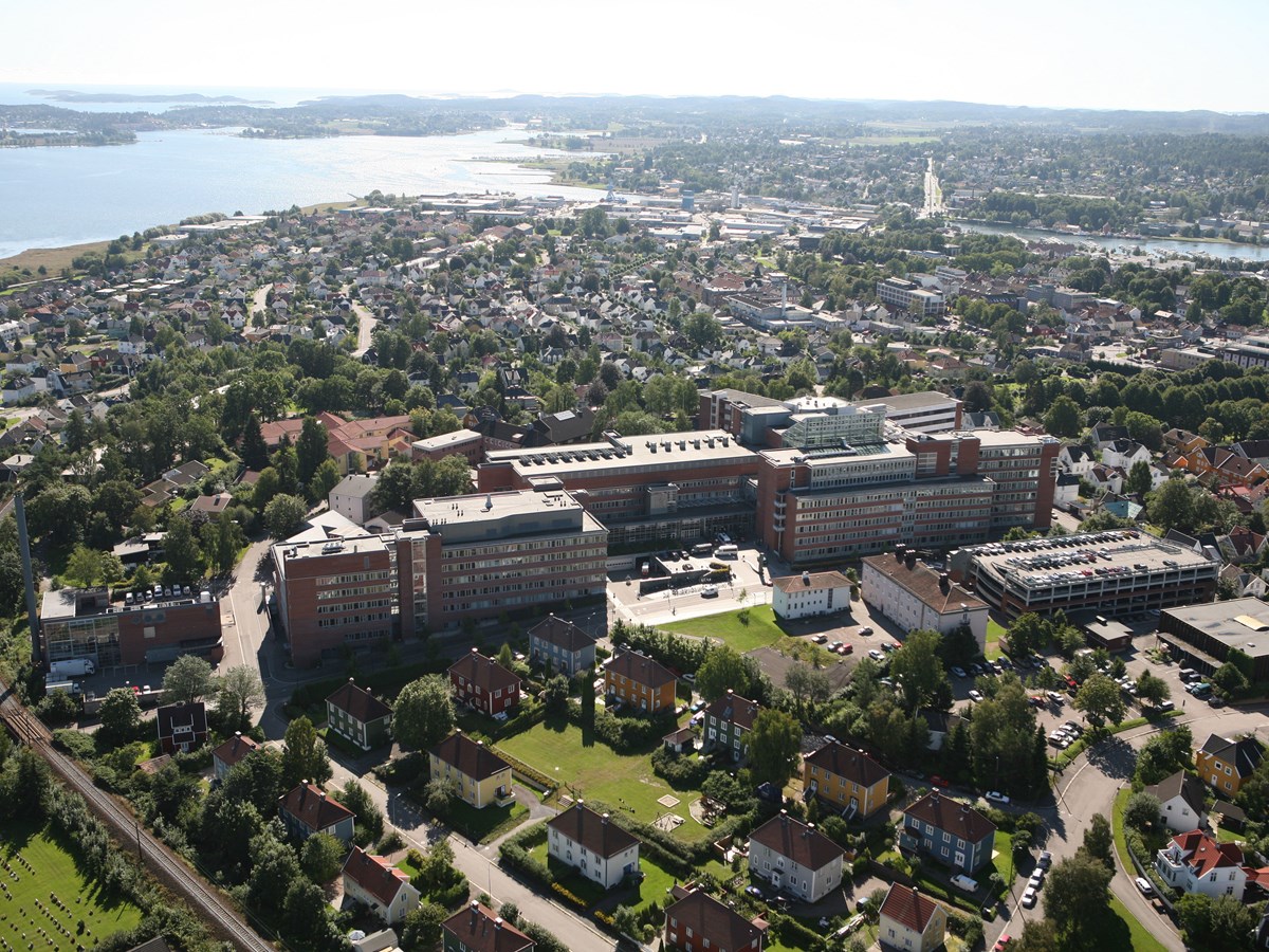 Det nye sykehuset i Tønsberg er et digert prosjekt, men kontraktsformen kan ha overføringsverdi til mellomstore og små prosjekter.